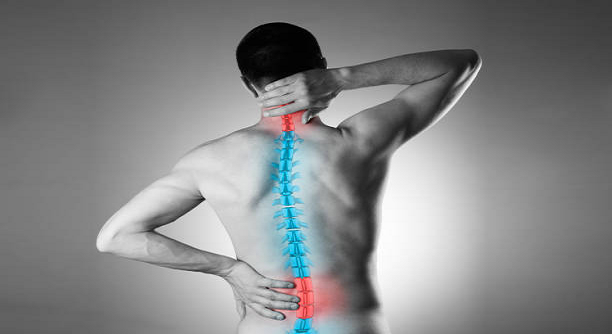 Backpain Sciatica 1